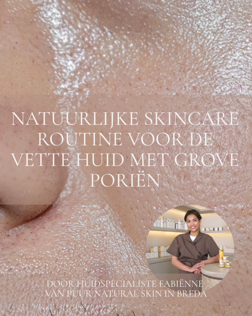 natuurlijke huidverzorging skincare routine voor de vette huid met grove poriën