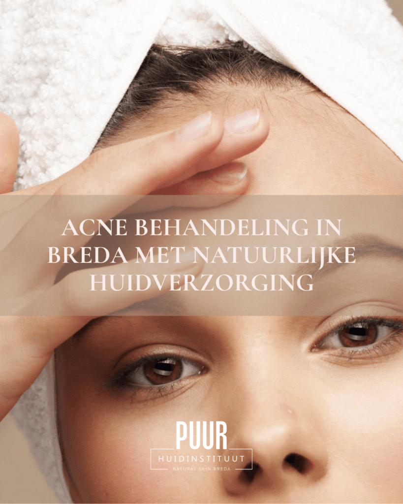 Acne behandeling in Breda met natuurlijke huidverzorging bij PUUR Huidinstituut | Natural Skin Breda