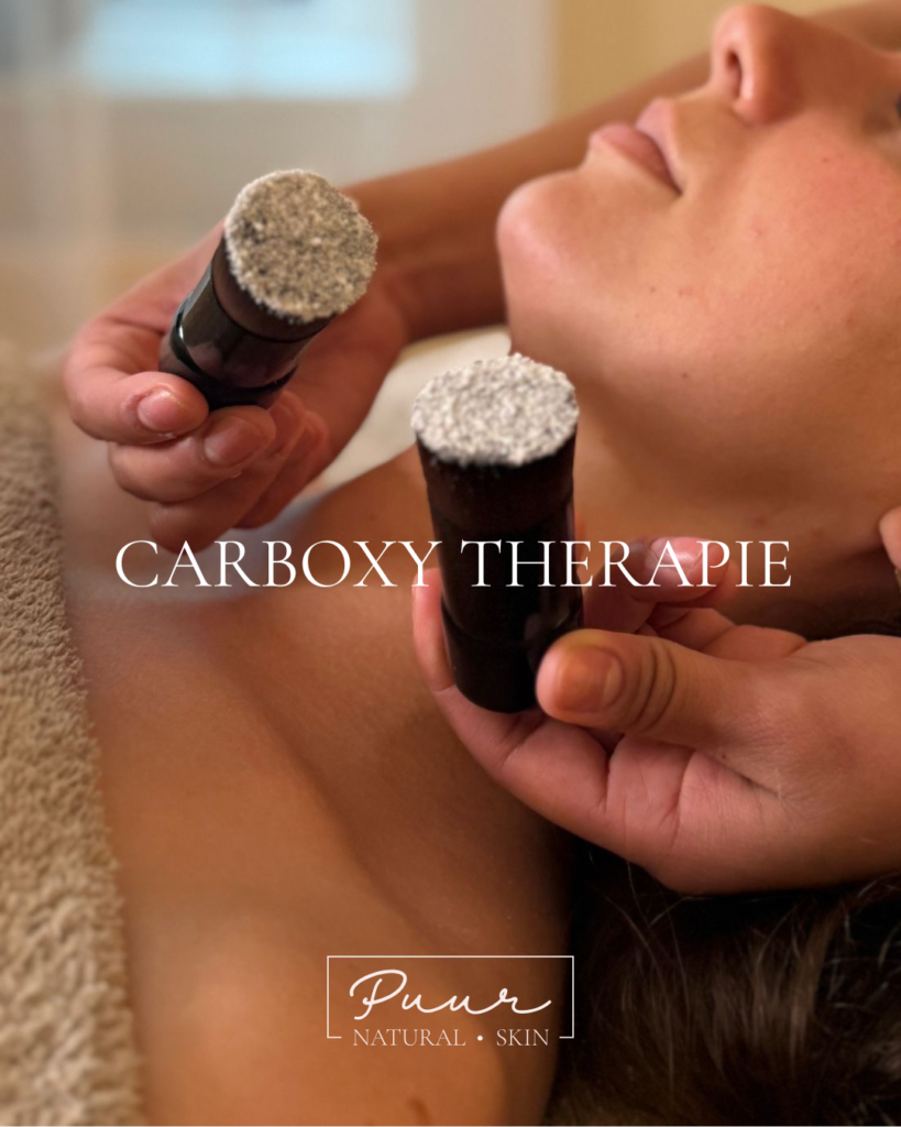 Natuurlijke carboxy therapie bij PUUR Huidinstituut | Natural Skin Breda