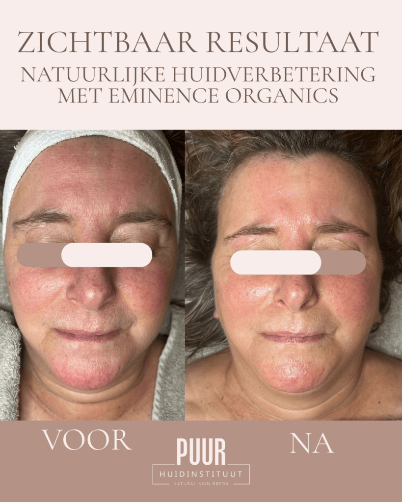 Eminence organics PUUR Huidinstituut Natural Skin Breda