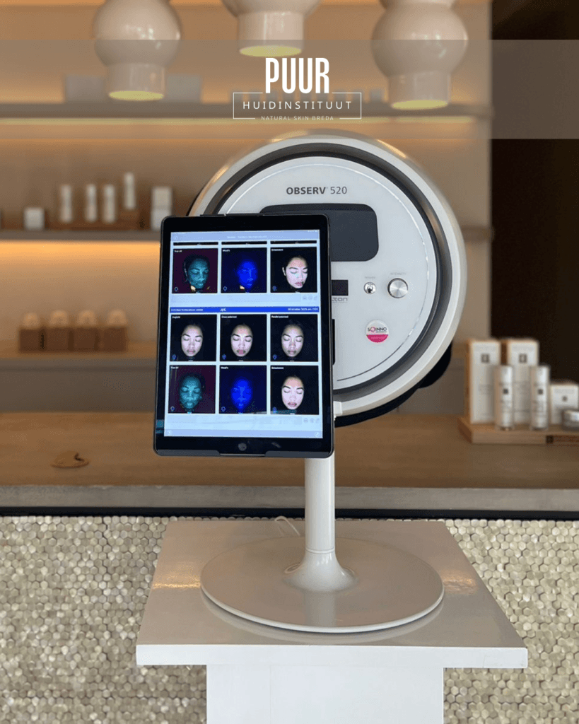 Observ huidscan bij PUUR Huidinstituut Natural Skin in Breda