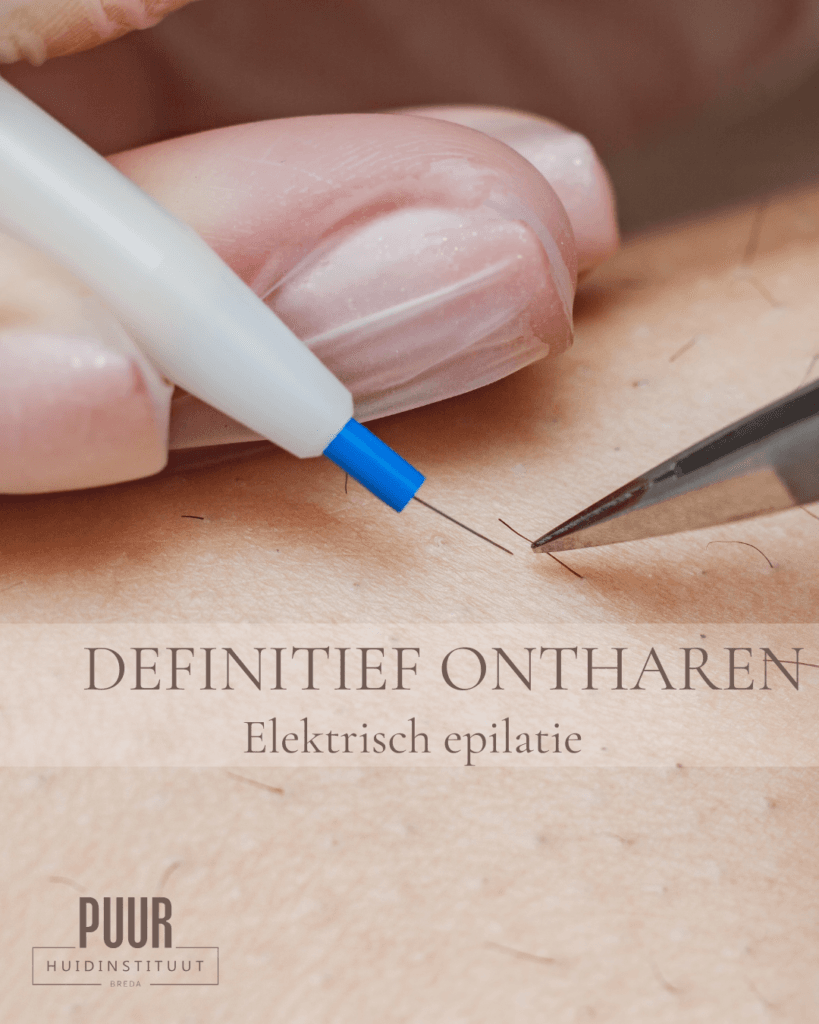 Elektrische epilatie bij PUUR Huidinstituut Breda