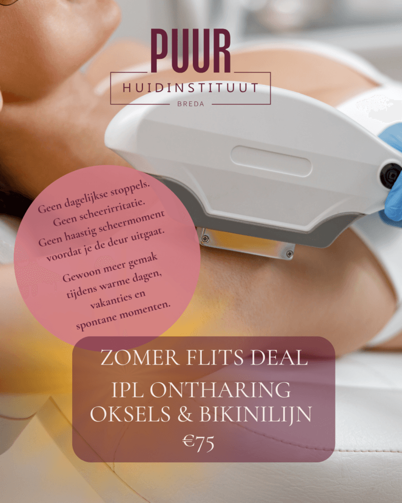 IPL lichtflits definitief ontharing Summer flitsdeal PUUR Huidinstituut Breda